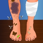 Smelly feet surgery