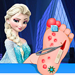 Elsa Foot Surgery