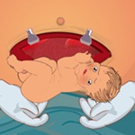 Sofia Cesarean Birth