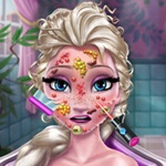 Elsa Skin Treatment